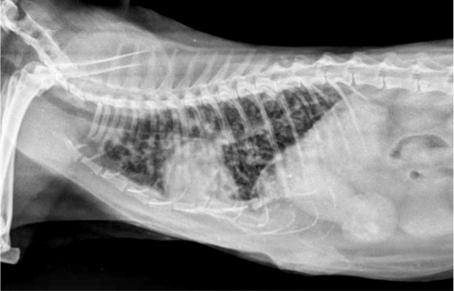  Raio-x lateral de tórax esquerdo sugestivo  de metástase pulmonar difusa.  